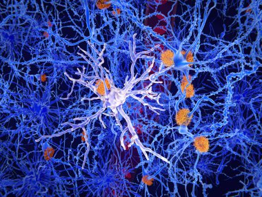Mikroglia hücresi. Alzheimer hastalığının patogenezinde önemli bir rol oynar