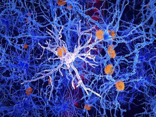 Una célula de microglía. Desempeña un papel importante en la patogénesis de la enfermedad de Alzheimer —  Fotos de Stock