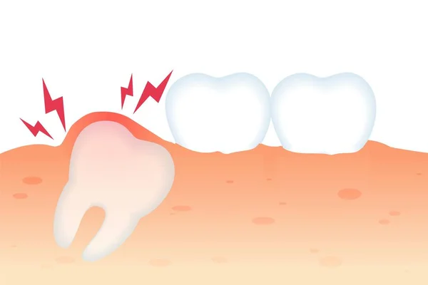 Diş Büyüme Düz Vektör Gerçekçi ile Diş Ağrısı. — Stok Vektör
