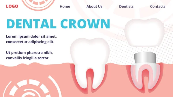 Diş Taç Yatay Afiş. Diş Restorasyonu — Stok Vektör