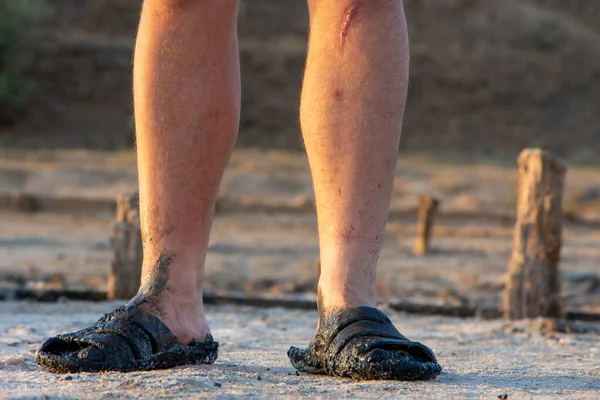 Bosé Nohy Sandálech Špinavé Nohy Zraněními Bláto Nohou — Stock fotografie