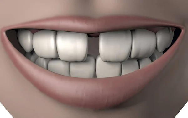 3d illustration of woman mouth full of strong white teeth with g
