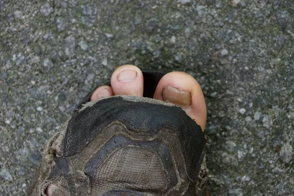 Sapatilha Esfarrapada Com Dedos Asfalto — Fotografia de Stock