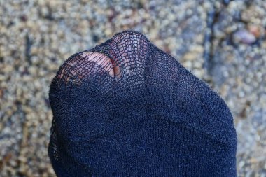 Siyah bir eski yırtık çorap bacak üzerinde bir parmak