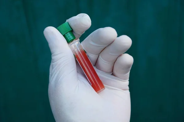 Offenes Reagenzglas Mit Blut Der Hand Handschuh Auf Grünem Hintergrund — Stockfoto