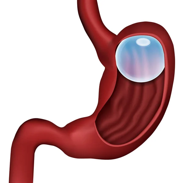 Globo Esófago Vector Médico Ilustración Sin Etiqueta Sobre Fondo Blanco — Vector de stock