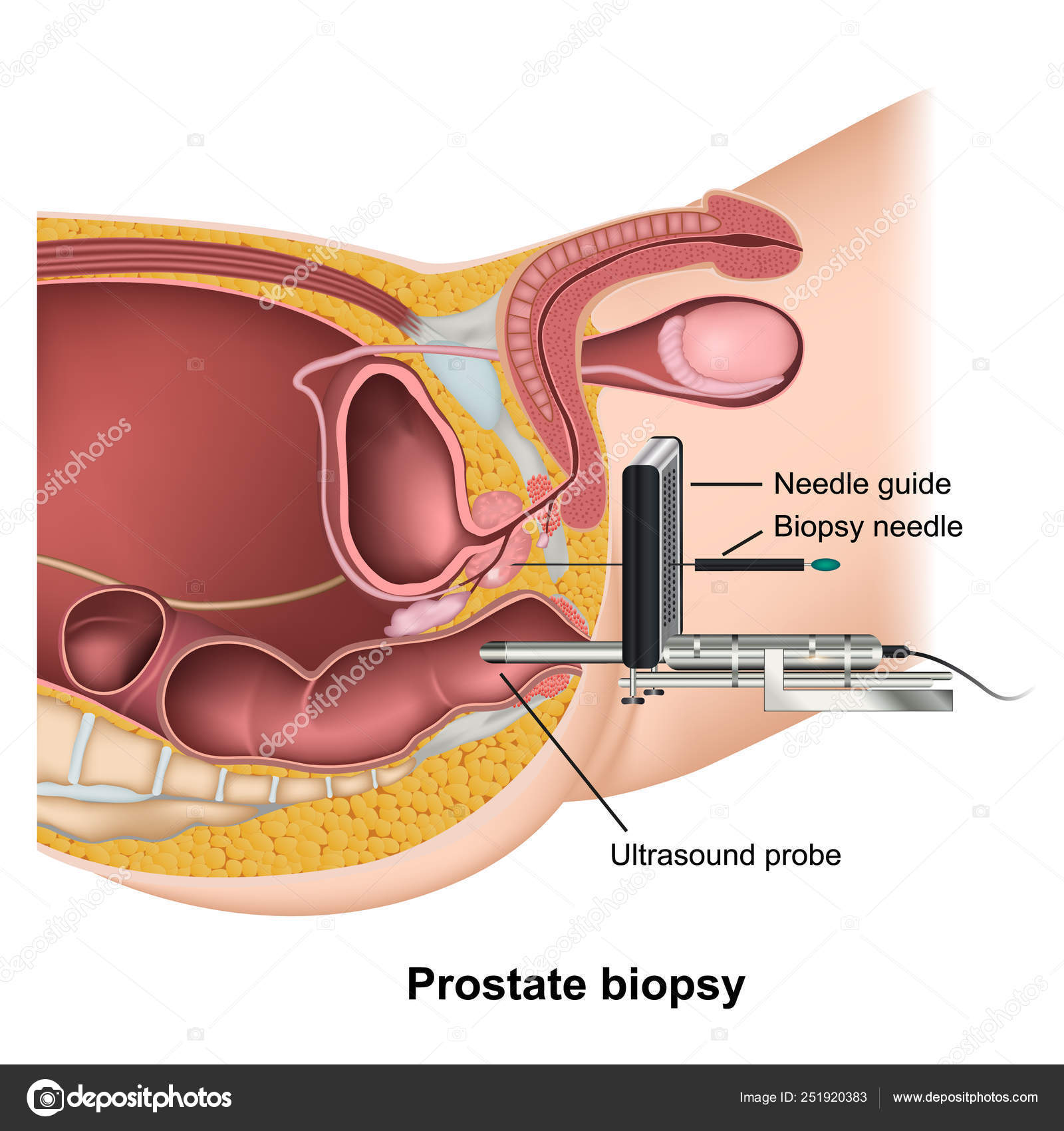 adenoma prostatico liver