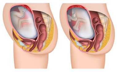 fetus pozisyon 3d tıbbi vektör illüstrasyon