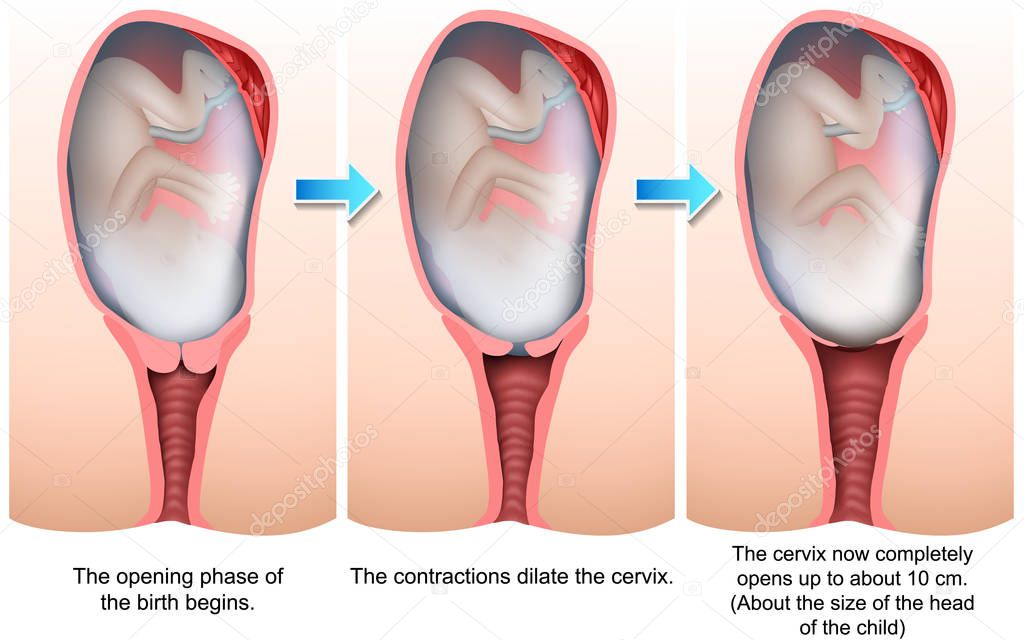 Stages of birth 3d medical vector illustration