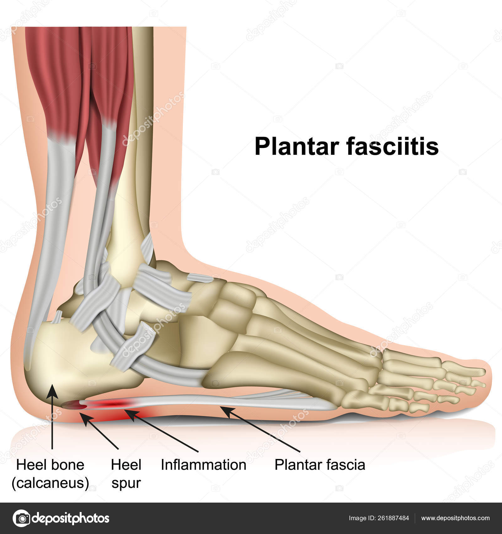 outside foot pain