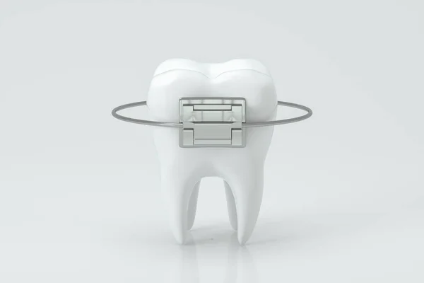 Aparelhos Dentários Dentes Renderização Desenho Digital Computador — Fotografia de Stock