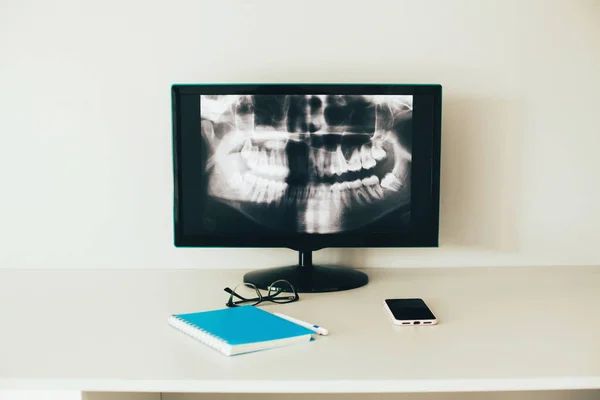 X-ray of the jaw on the monitor.