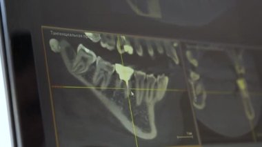 çene monitörde 3D resmi