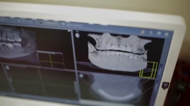 3D bilgisayar ekranında çene