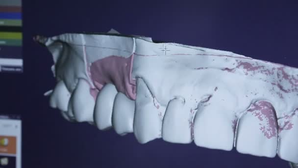 Le technicien dentaire voit le modèle 3D de l'implant dans la mâchoire — Video