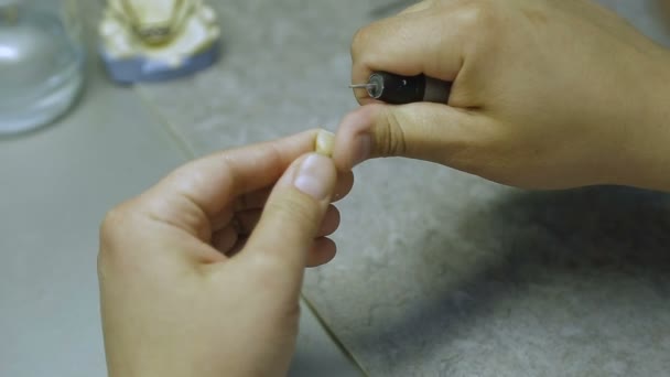 Técnico dental muele la corona — Vídeo de stock