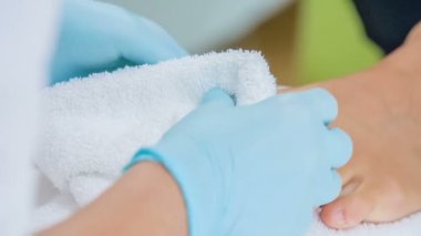 Kadın pedikürcü yavaşça çok yaralı ve ağrılı büyük başbaş kenarlarına özel şifa krem büyük miktarda uyguluyor.