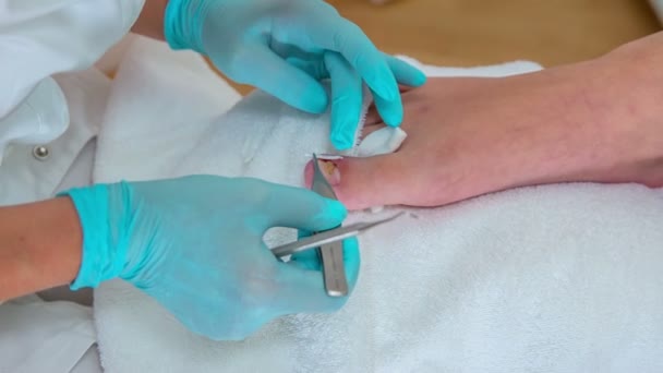 Fußpflegerin Appliziert Sanft Riesige Menge Spezieller Heilcreme Auf Die Ränder — Stockvideo