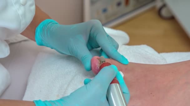 Female Pedicurist Gently Applying Huge Amount Special Healing Creme Edges — Stock Video