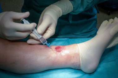 bir doktor bir cerrahi işlem yapar