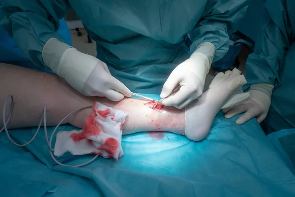 Un medico esegue un'operazione chirurgica — Foto Stock