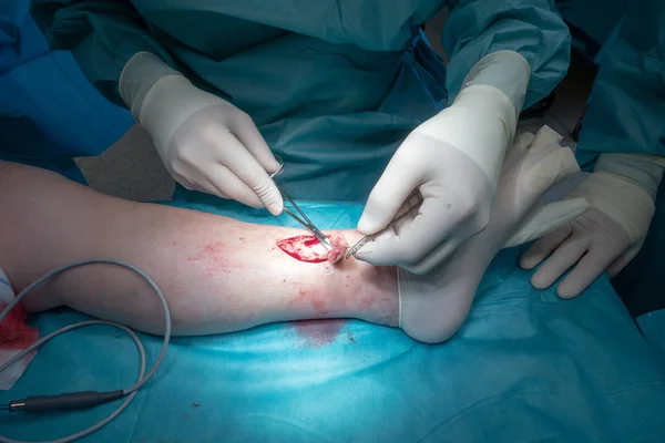 Lekarz wykonuje operację chirurgiczną — Zdjęcie stockowe