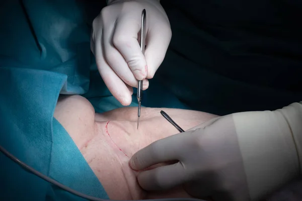 A doctor performs a surgical operation — Stock Photo, Image