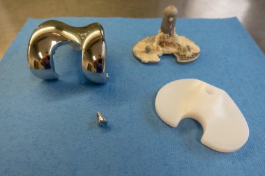 Diz protezi kaldırılan implantlar