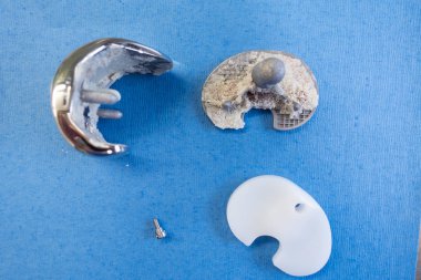 Diz protezi kaldırılan implantlar