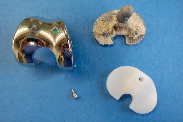 Os implantes retirados de uma prótese de joelho — Fotografia de Stock