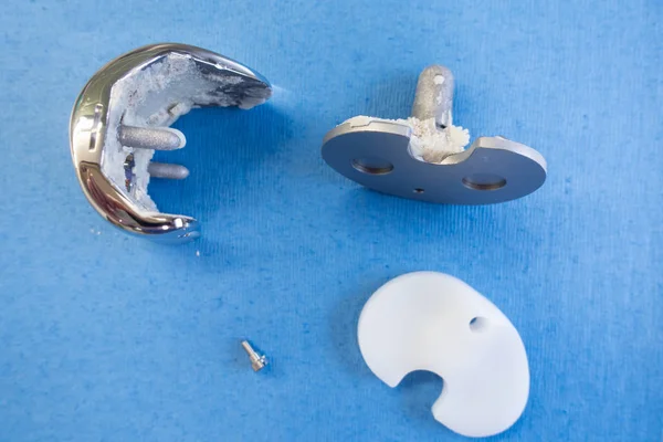 Removed implants of a knee prosthesis — Stock Photo, Image