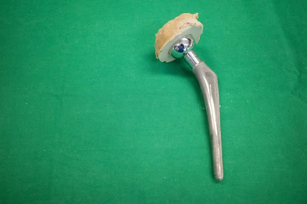 Explanted Hip Prosthesis Cleaned Lies Green Surgical Drap — Stock Photo, Image