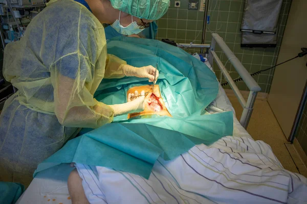 Sali Operacyjnej Lekarz Szyje Ranę Brzuchu — Zdjęcie stockowe