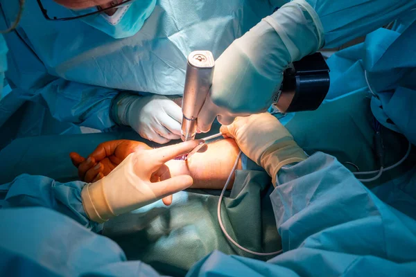 Ameliyathanede Bilek Kırığını Ameliyat Eden Iki Doktor — Stok fotoğraf