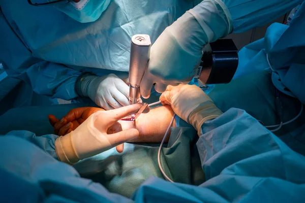 Twee Artsen Opereren Aan Een Polsfractuur Een Operatiekamer — Stockfoto