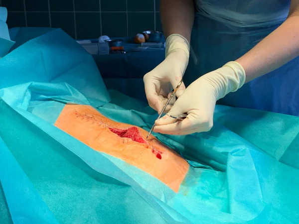 Bir Doktor Karnındaki Yarayı Iğne Tutacağı Cerrahi Dikiş Malzemesi Ile — Stok fotoğraf