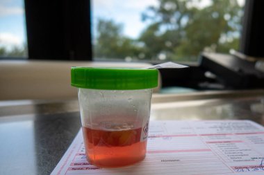 Laboratuvarda geçirilen bir ameliyattan sonra doku hazırlığı