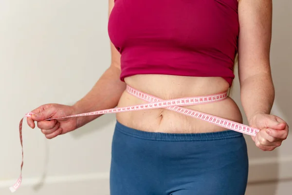 Closeup of woman pinching belly fat. Young slim woman in blue shorts pinching her abdomen. Diet and weight loss concept. — Stock Photo, Image