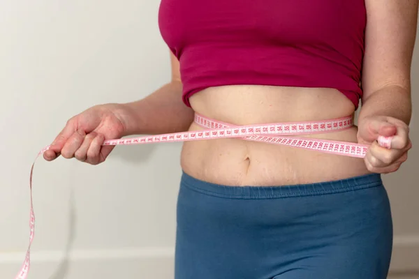 Closeup of woman pinching belly fat. Young slim woman in blue shorts pinching her abdomen. Diet and weight loss concept. — Stock Photo, Image