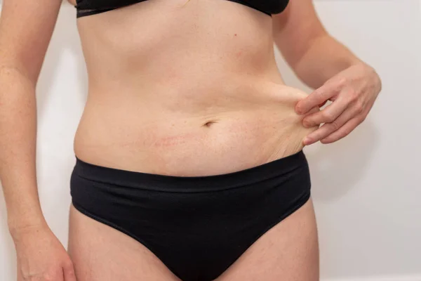 Fat female belly, woman holding her skin for cellulite check. Getting rid of belly fat and weight loss. Women body fat belly front view.