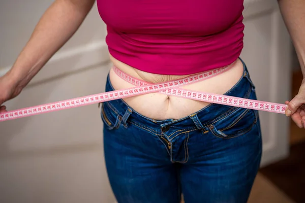 Closeup Woman Pinching Belly Fat Young Slim Woman Blue Shorts — Stock Photo, Image