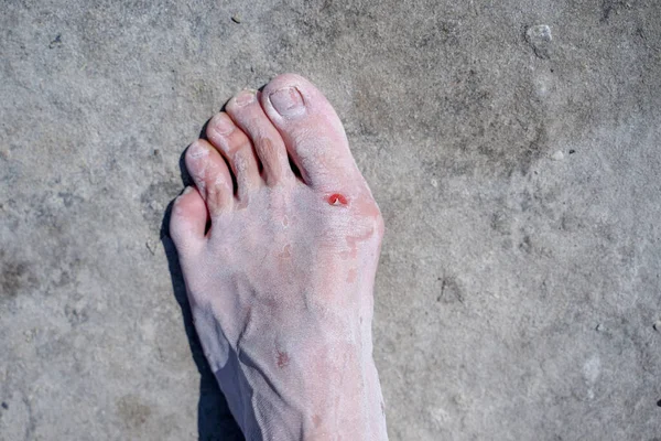Bare feet of men in the pink salt lake. Salt Deposit. Treatment of wounds with salt. Healing properties of salt — Stock Photo, Image
