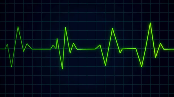 Groene Hartslag Puls Aan Cardiogram Scherm Ekg Ecg Cardio Gezondheidszorg — Stockfoto