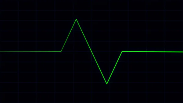 Groene Hartslag Puls Aan Cardiogram Scherm Ekg Ecg Cardio Gezondheidszorg — Stockfoto
