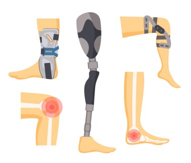 Pain in Joints and Orthopedic Retainers on Legs clipart