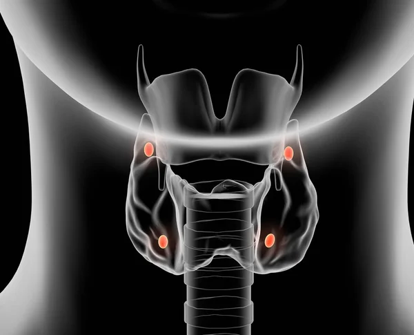 Thyroid gland of a woman with highlighted parathyroid, medically — Stock Photo, Image