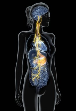 Vagus nerve with painful stomach and digestive system, 3D medically illustration