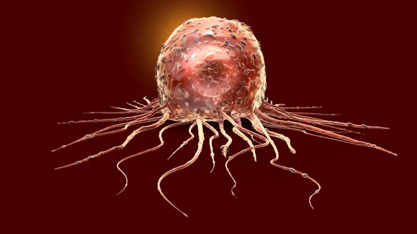 Célula cancerosa, ilustración médicamente 3D — Foto de Stock
