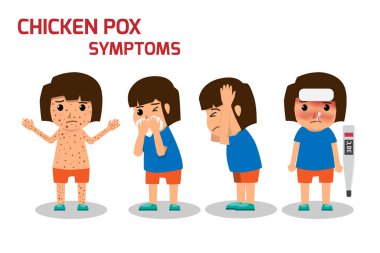 Çocuk babasıdır suçiçeği Infographic, Poster çocuklar ateş ve su çiçeği belirtileri ve korunma. Sağlık çizgi film karakteri vektör çizim.