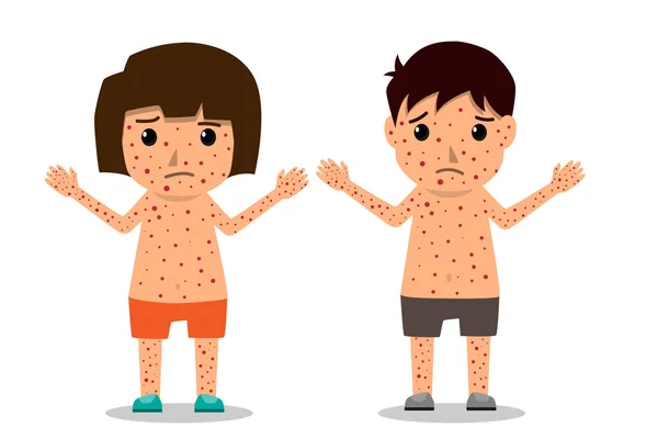 儿童有水痘图表 海报儿童发热和水痘症状和预防 健康护理卡通人物矢量插画 — 图库矢量图片